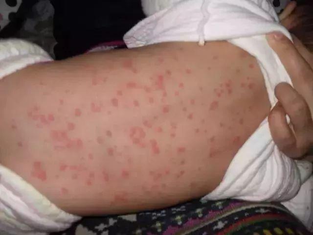 「生活」凉席里有600万只螨虫!而且光清洗+暴晒是没有用的……这招只要2分钟搞定