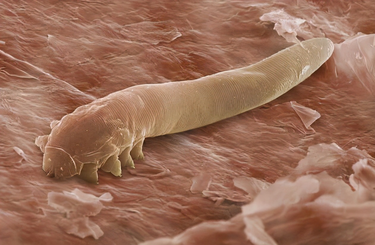 ɹ���Ӻ�Ϊ���С�̫��ζ���������汻�����ˣ��·���������Ĺ���